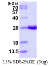 Human GSTA4 protein, His tag. GTX67437-pro