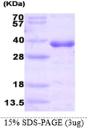 Human HNMT protein, His tag. GTX67469-pro
