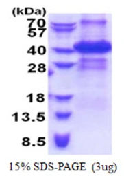 Human ING2 protein, His tag. GTX67505-pro