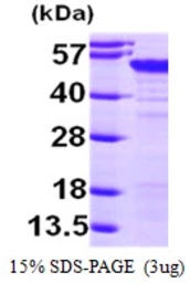 Human MAGEA4 protein, His tag. GTX67534-pro