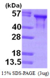 Human Tau381 (1N3R) protein, His tag. GTX67539-pro