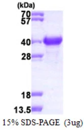 Human NACA1 protein, His tag. GTX67574-pro