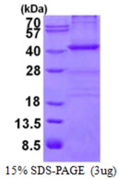 Human Nucleophosmin protein, His tag. GTX67599-pro