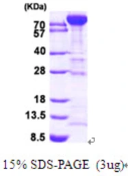 Human PFKM protein, His tag. GTX67627-pro
