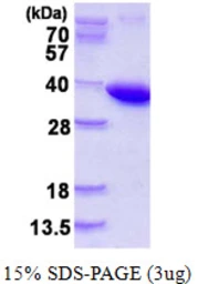 Human PPA1 protein, His tag. GTX67658-pro