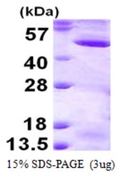 Human MEK2 protein, His tag. GTX67683-pro