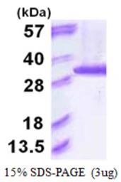 Human PSMA6 protein, His tag. GTX67694-pro