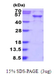 Human RAB3IL1 protein, His tag. GTX67723-pro