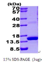 Human S100A9 protein, His tag. GTX67795-pro