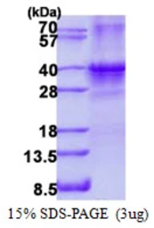 Human SIX1 protein, His tag. GTX67820-pro
