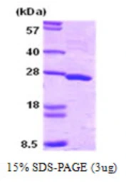 Human SNAP25 protein. GTX67826-pro