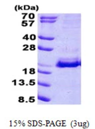 Human SRP19 protein, His tag. GTX67853-pro