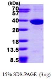 Human SULT1C2 protein, His tag. GTX67863-pro