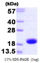 Human Troponin C fast skeletal protein. GTX67890-pro