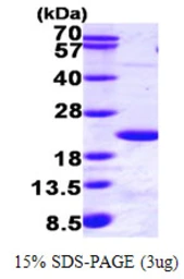 Human UBE2B protein, His tag. GTX67914-pro