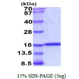 Human UBE2L3 protein. GTX67924-pro