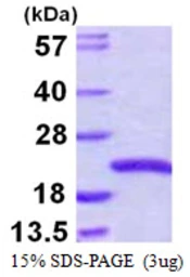 Human SNX3 protein, His tag. GTX67997-pro