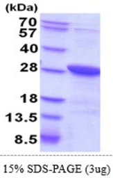 Human Securin protein, His tag. GTX68036-pro