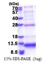 Human C5orf13 protein, His tag. GTX68044-pro