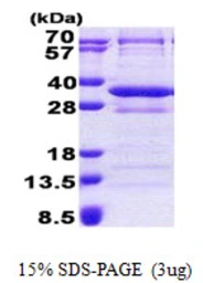 Human CNOT8 protein, His tag. GTX68047-pro