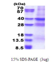 Human MED27 protein, His tag. GTX68056-pro