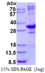 Human CRSP9 protein, His tag. GTX68057-pro