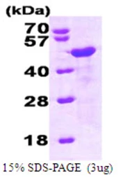 Human Homer1 protein, His tag. GTX68063-pro