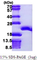 Human EEF1E1 protein, His tag. GTX68071-pro