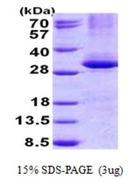 Human CPSF4 protein, His tag. GTX68197-pro