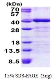 Human TOMM34 protein, His tag. GTX68206-pro