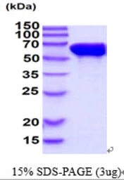 Human STIP1 protein. GTX68209-pro