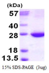 Human RAB31 protein, His tag. GTX68217-pro