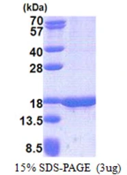Human TUSC2 protein, His tag. GTX68248-pro
