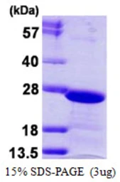 Human HP1 gamma protein, His tag. GTX68249-pro
