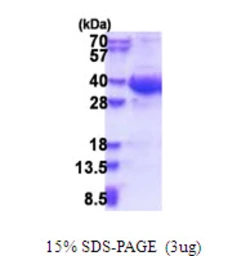 Human EXOSC8 protein, His tag. GTX68251-pro