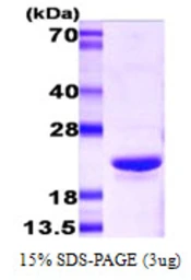 Mouse alpha B Crystallin protein. GTX68257-pro