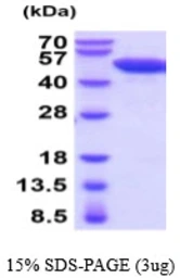 Mouse NSE protein, His tag. GTX68261-pro