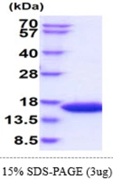 Mouse L-FABP protein, His tag. GTX68262-pro