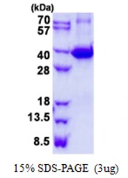 Mouse Galectin 9 protein, His tag. GTX68272-pro