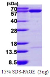 Human NT5C2 protein, His tag. GTX68310-pro