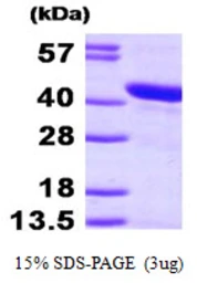 Human HSPBP1 protein, His tag. GTX68343-pro