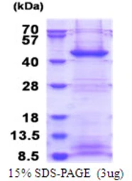 Human FBXO2 protein, His tag. GTX68376-pro