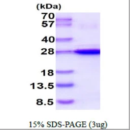 Human HSP22 protein, His tag. GTX68382-pro
