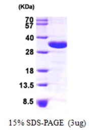 Human CHMP2A protein, His tag. GTX68402-pro