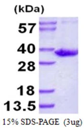 Human SULT1B1 protein, His tag. GTX68408-pro