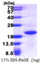Human CRCP protein, His tag. GTX68410-pro