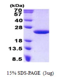Human MCTS1 protein, His tag. GTX68422-pro