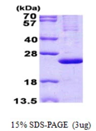 Human MRPL13 protein, His tag. GTX68424-pro