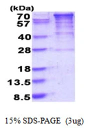 Human eEF2K protein, His tag. GTX68446-pro