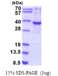 Human PYCR2 protein, His tag. GTX68447-pro